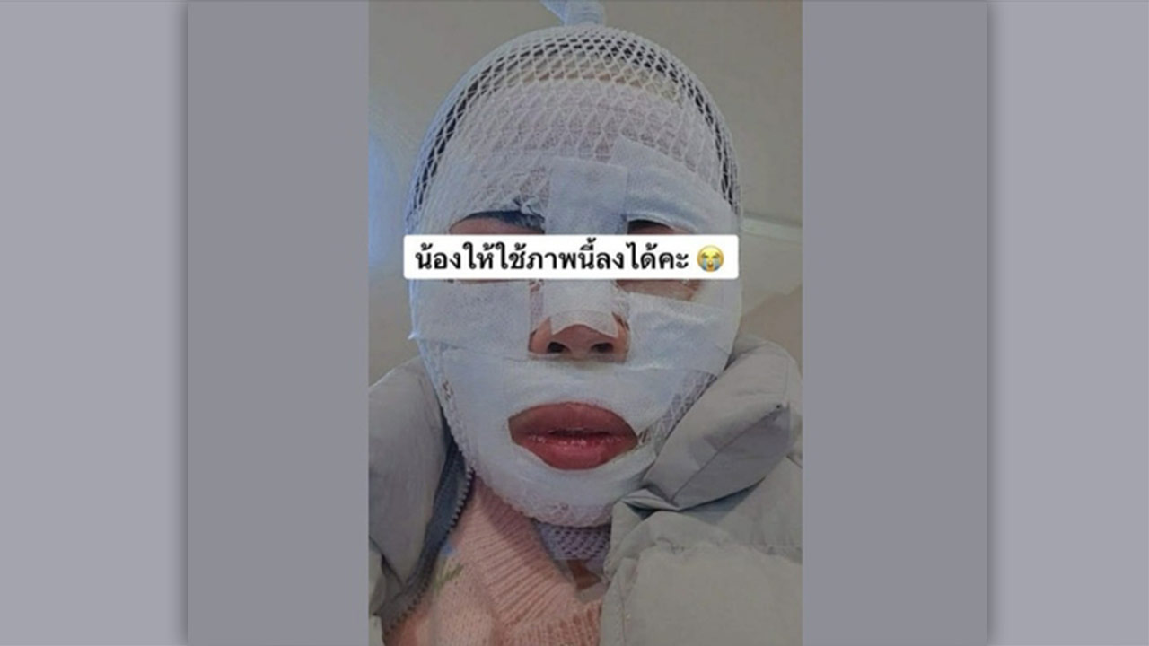 경찰, 태국인 아내 얼굴에 끓는 물 부은 40대 구속영장 신청