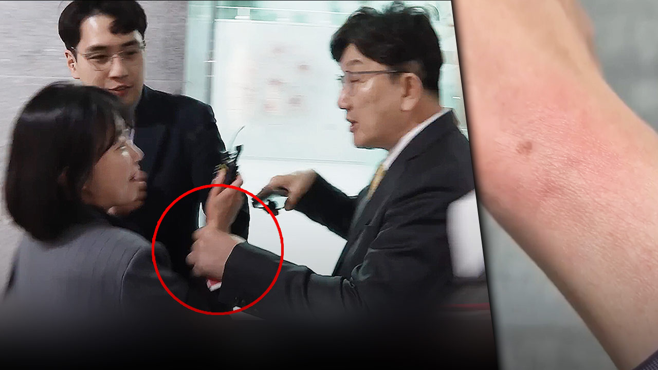 경찰, 기자 폭행 혐의 권성동 '기소 의견' 송치