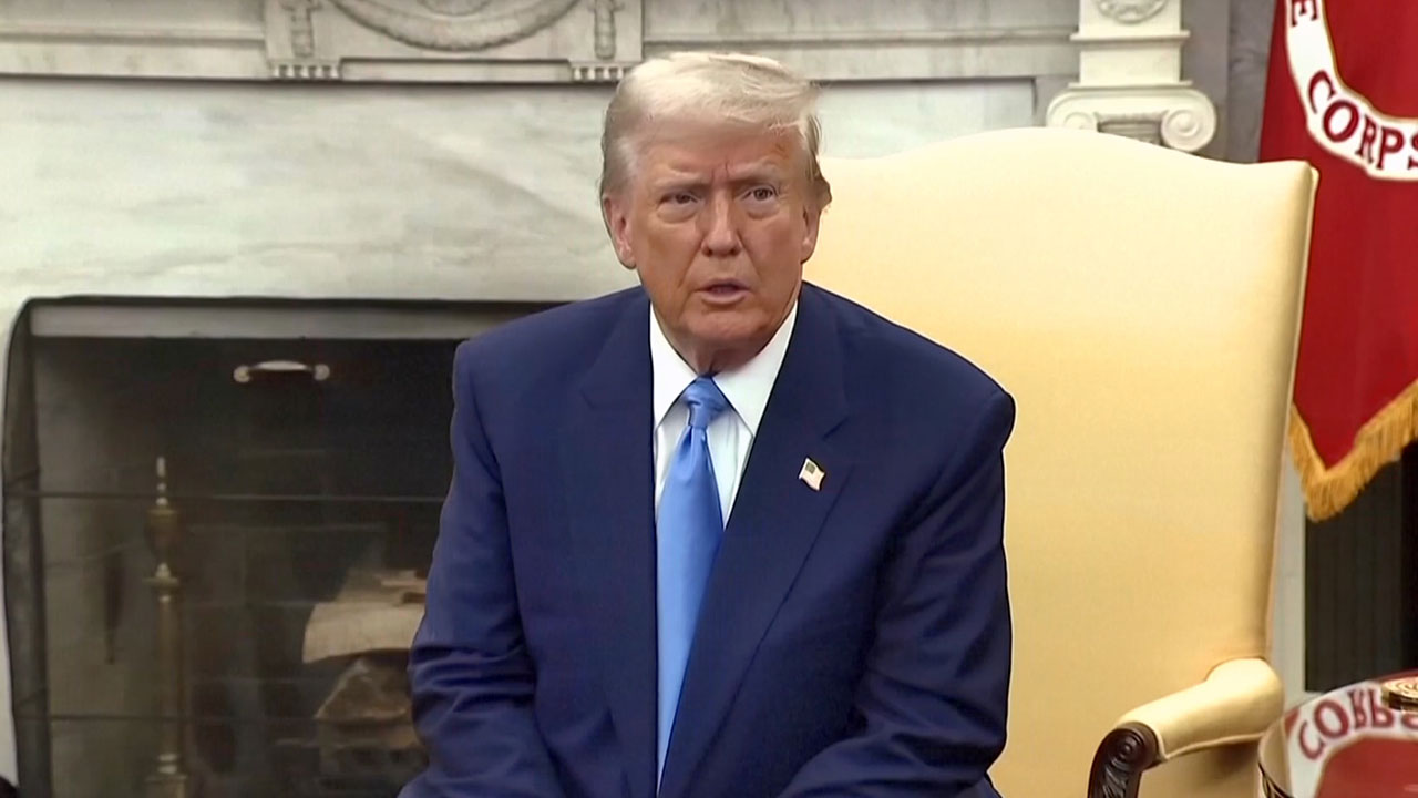 [World Now] 트럼프 오른손 멍자국 설왕설래‥악수탓? 건강 문제?