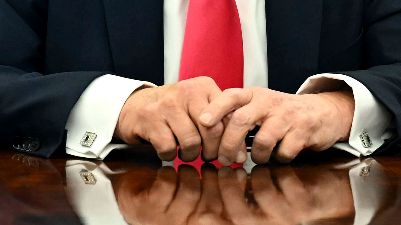 [World Now] 트럼프 오른손 멍자국 설왕설래‥악수탓? 건강 문제?