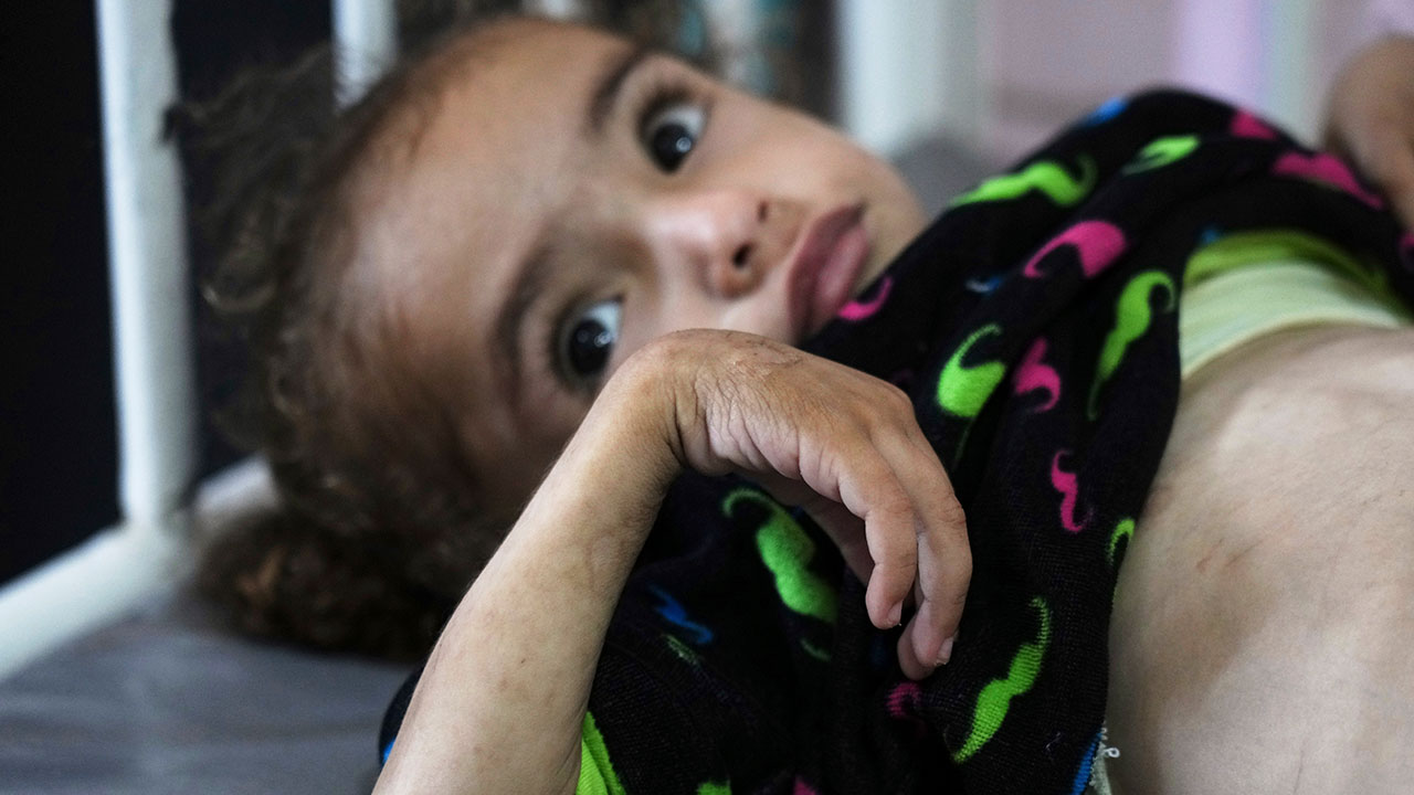 "가자지구 4살 소년 영양실조로 숨져‥아사자 58명"