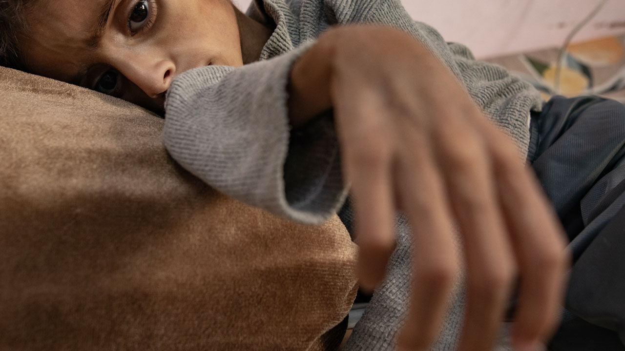 "가자지구 급성 영양실조 아동 3배 급증‥아사 직전 사례도 증가"