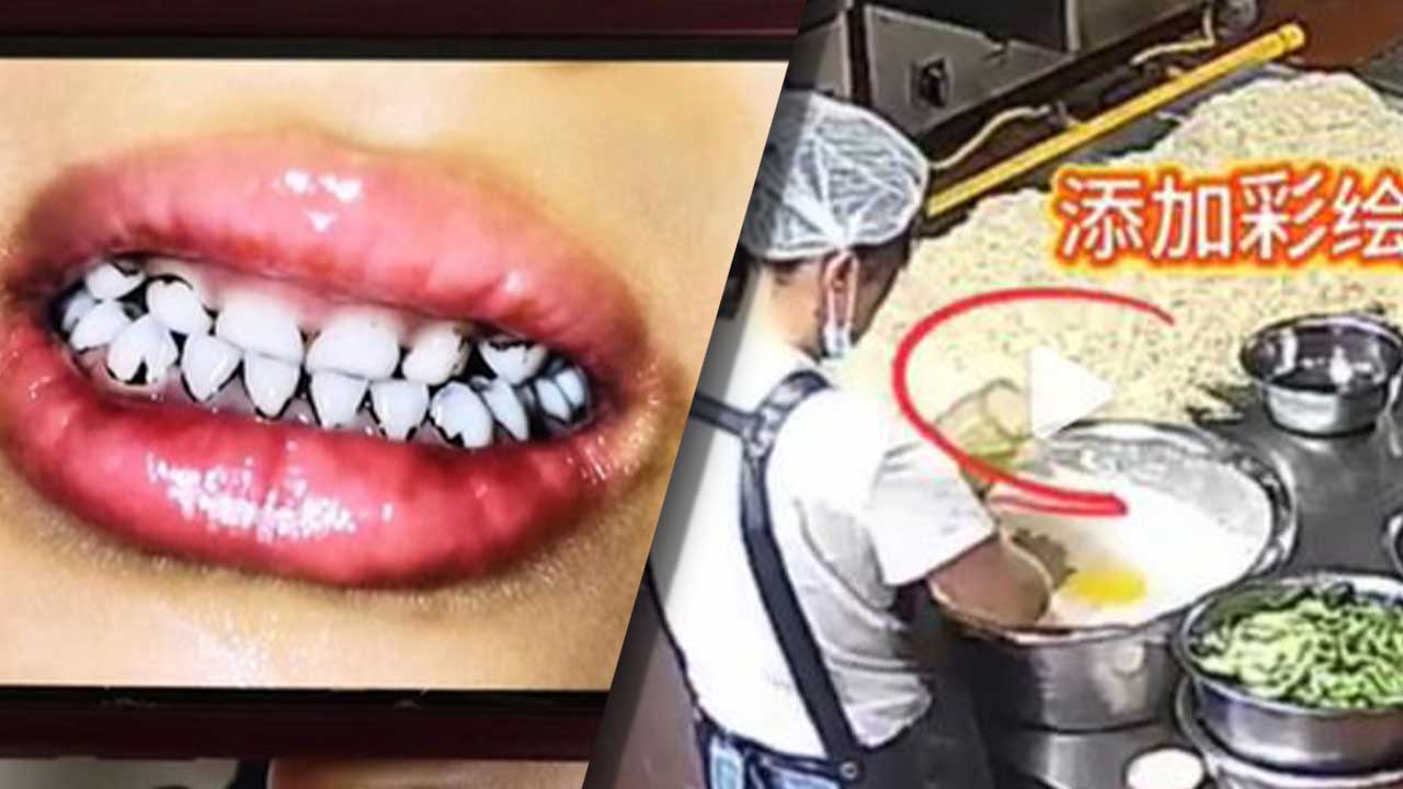 '중국 유치원 납중독' 급식 반죽에 미술 물감 풀어‥피해 원생 2백여 명 