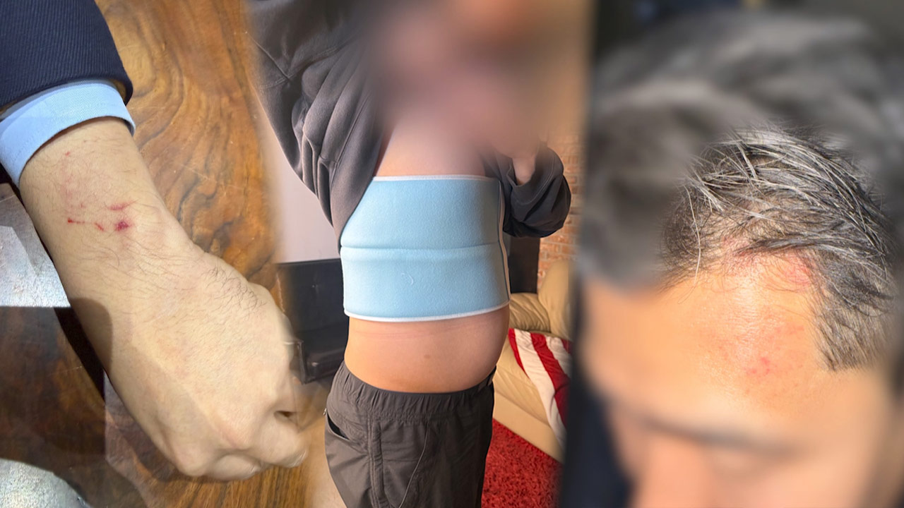 하청업체 직원 폭행 '호카' 총판 대표 사퇴‥"돌이킬 수 없는 잘못"