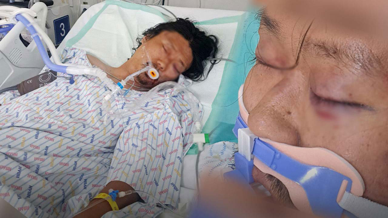 [단독] 김창민 감독 상해치사 피의자들 '살인죄' 적용‥이르면 오늘 기소