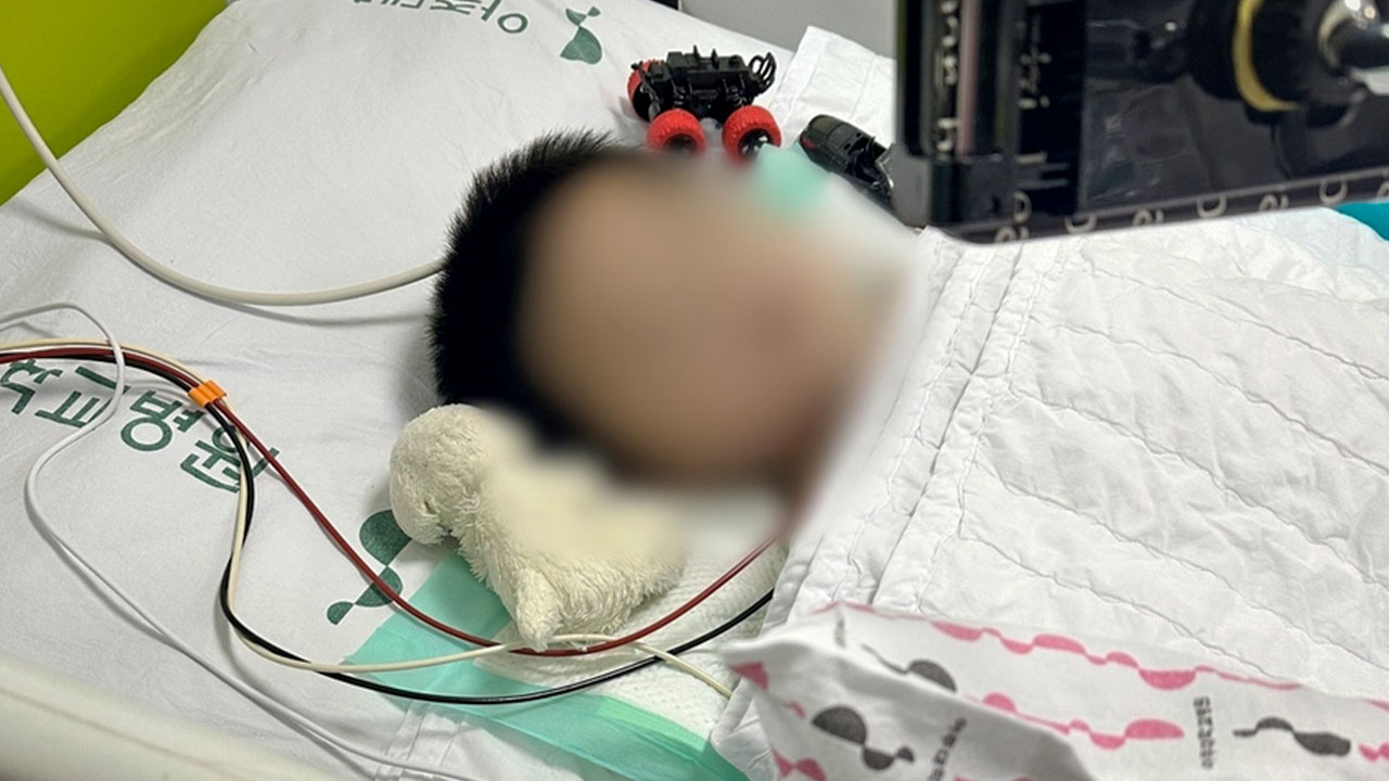 어린이집 5m 창문 밖으로 2살 아기 추락… 이틀째 중환자실 투병 중