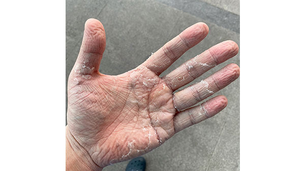 [팩트의 무게] 코로나 6개월, 이 손 기억하세요?