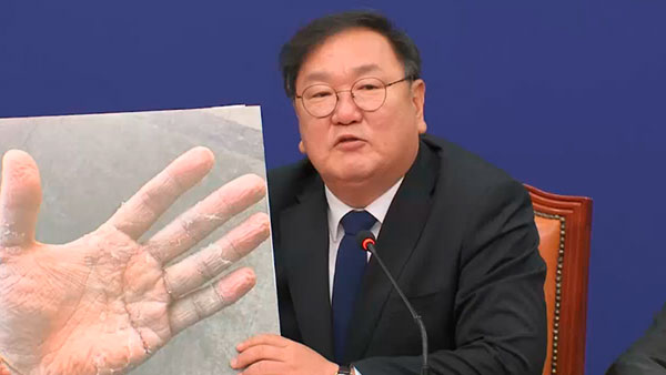 [팩트의 무게] 코로나 6개월, 이 손 기억하세요?