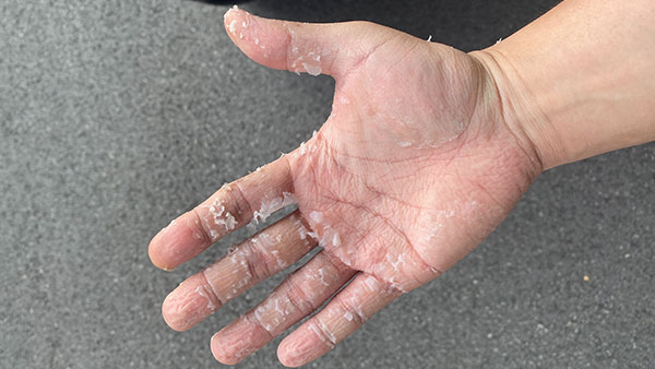 [팩트의 무게] 코로나 6개월, 이 손 기억하세요?