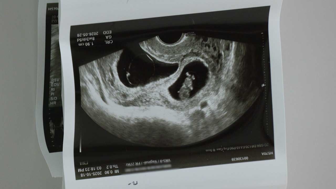 쌍둥이 예비아빠 꿈 짓밟은 만취운전‥'징역 8년'에 갇힌 재판부 [M피소드]