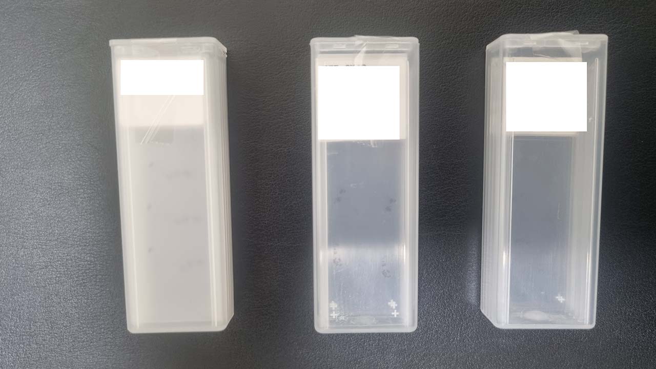 20년 만에 찾은 '신정동 연쇄살인범'‥'엽기토끼'는 여전히 미궁 [M피소드]