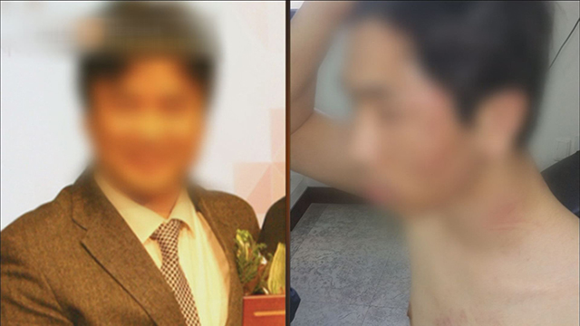[톡톡영상] '인분 교수'는 원래 친절한 사람?