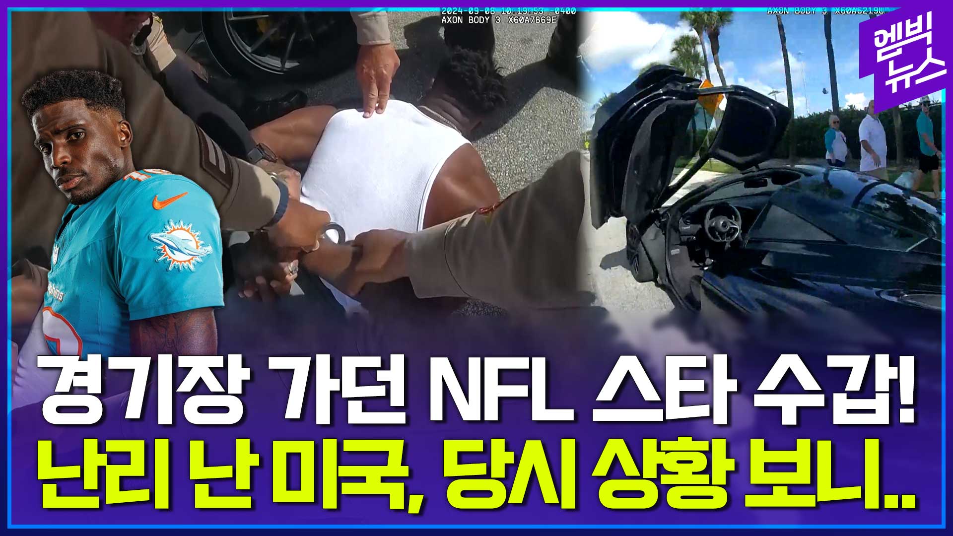 엠빅 이미지