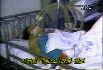 보건사회부 전국에 렙토스피라증 경보백지연