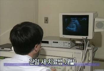 간암 새 치료법 개발정혜정