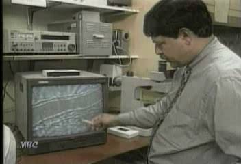 발생 6시간후까지 뇌졸증 치료 가능한 요법 발표이인용