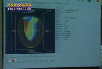"긍정적인 사고방식 심장병 재발 줄인다"이진숙