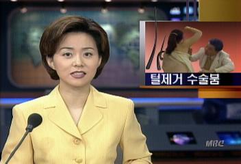 노출의 계절 여름 털제거 수술 붐김승환