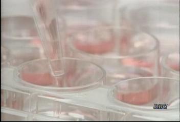 프랑스의 한 생물공학회사 음식 안 줄여도 살빼는 약 개발전영배