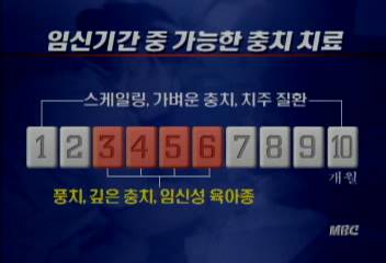 임산부 잇몸질환 치료 미루면 위험김승환