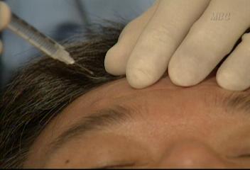 중년 남성들 주름살 뱃살 등 성형 열풍김승환