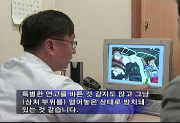 화상 정도 심한 화상환자 어린이들김승환