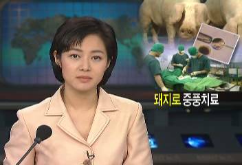 혈전증 치료제 만들어 내는 돼지 세계 최초 국내연구진 개발이진호