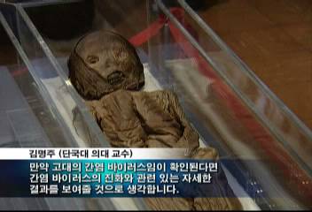미라에서 간염 바이러스가 발견된 것은 세계최초