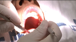 잘 씹어야 건강해진다치아 안 좋으면 치매 가능성 3배