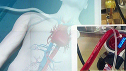 위독 환자 치료 장비 에크모 부족중환자 늘면 수급 차질