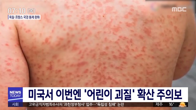 ë¯¸êµ­ì„œ ì´ë²ˆì—