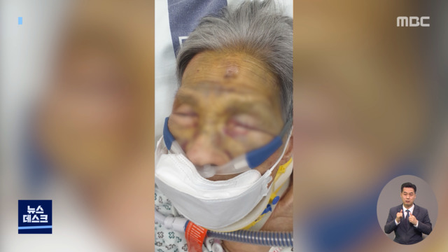 제보는 MBC 요양원이 낙상 방치해놓고뒤늦게 연락해 "보호자 책임"