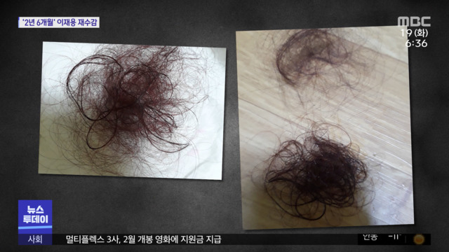 "아파서 손도 못 올려요"끝나지 않는 고통