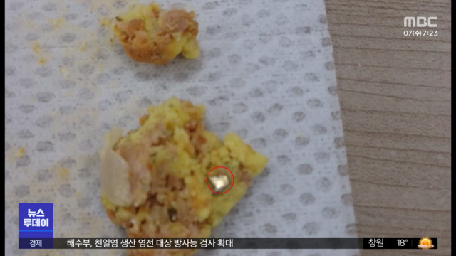 "빵 먹다 이 다쳤다"1천만 원 뜯어내