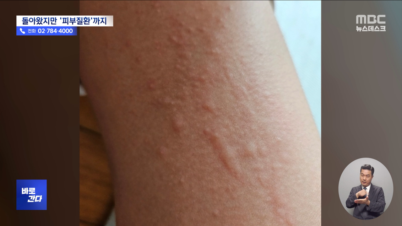 바로간다 "닦아도 닦아도 계속 나와요"두드러기에 발진 증상도 