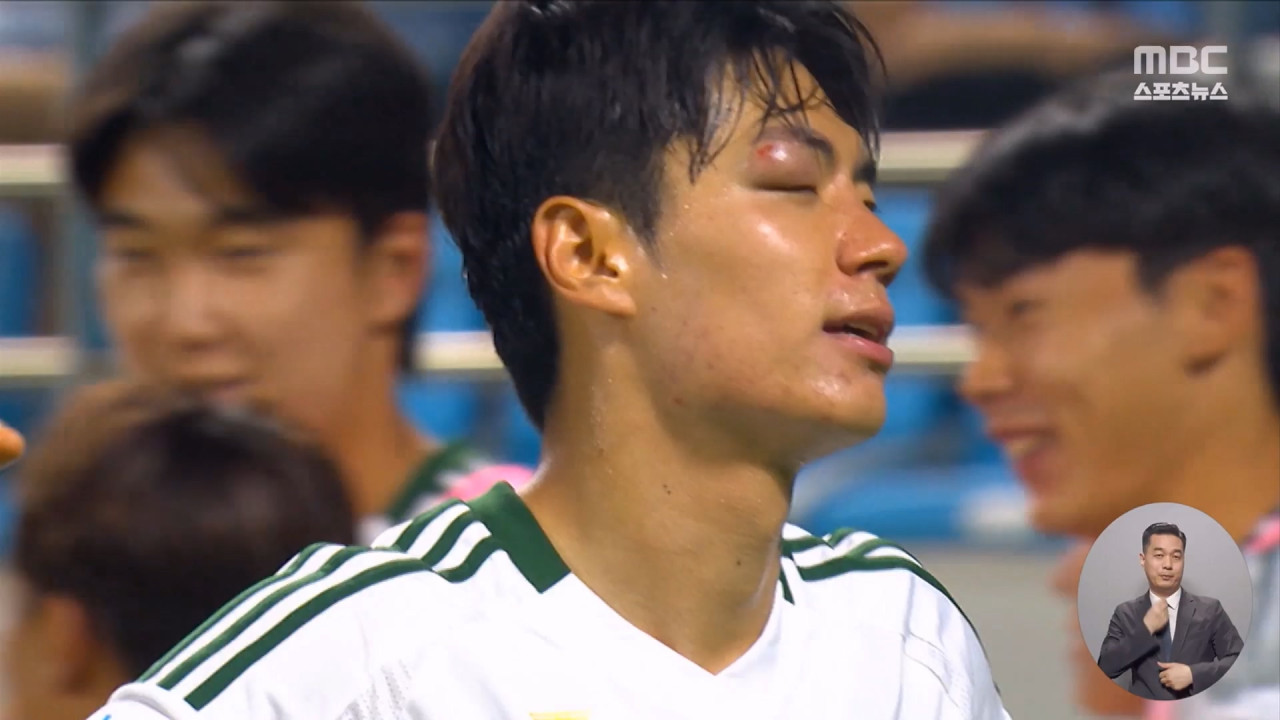 눈에 피멍 들고도 원더골 전진우 "한쪽 눈으로만 뛰는 느낌"