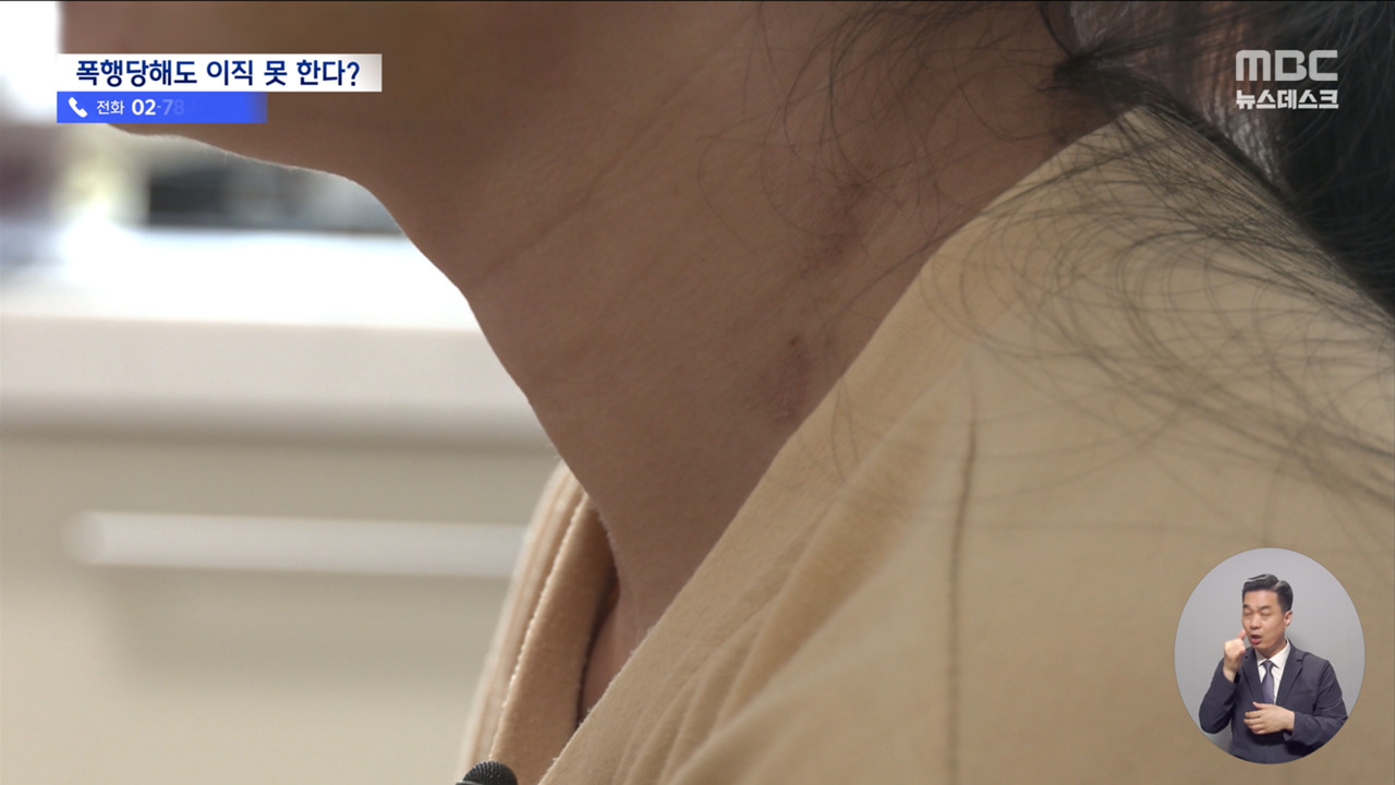 시퍼렇게 멍든 이주노동자"맞아도 회사 못 떠나"