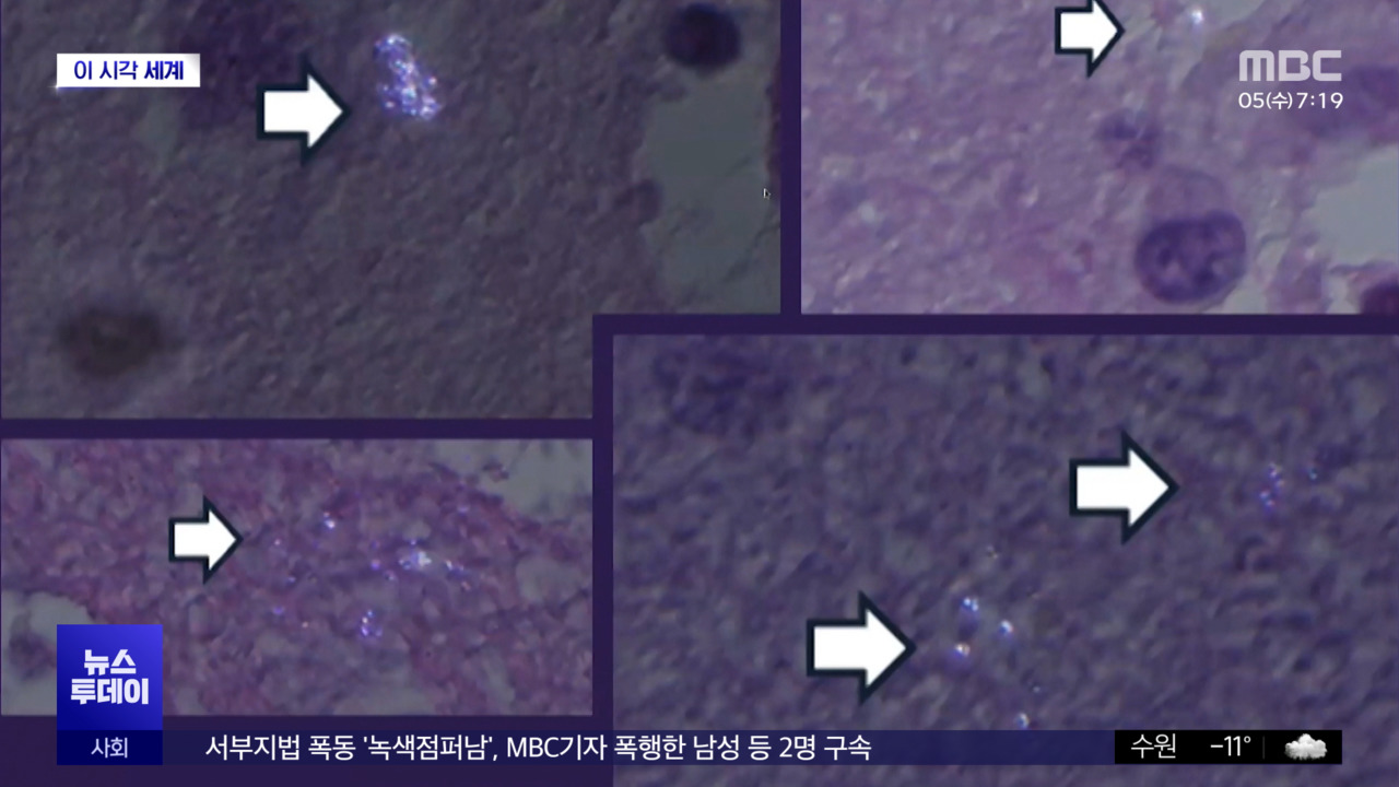 [이 시각 세계] 「脳内のスプーン」認知症、マイクロプラスチックの責任？