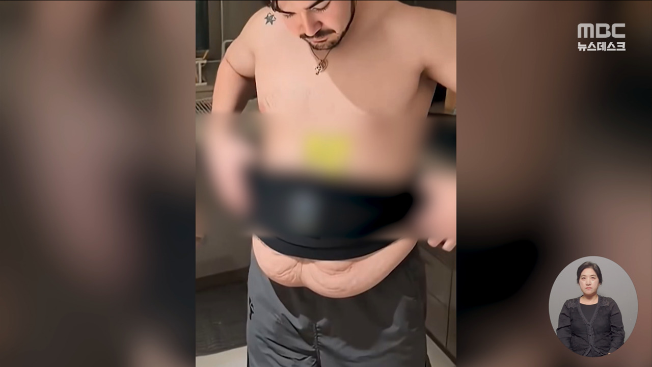 "먹으면 성인도 6cm 성장"‥AI 조작 광고 420건 적발
